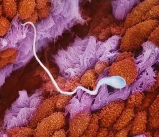 22 Stunning Pictures Depict The Stages Of Life Forming Until A Baby is Born 1