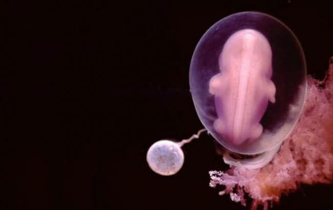 22 Stunning Pictures Depict The Stages Of Life Forming Until A Baby is Born 10