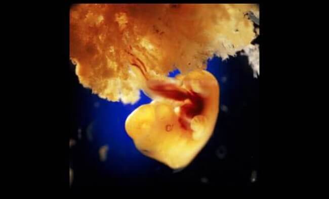 22 Stunning Pictures Depict The Stages Of Life Forming Until A Baby is Born 12