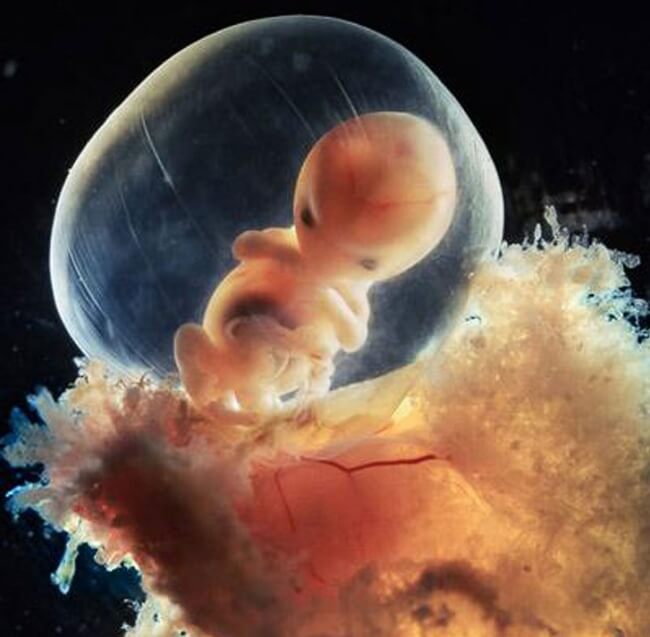 22 Stunning Pictures Depict The Stages Of Life Forming Until A Baby is Born 13