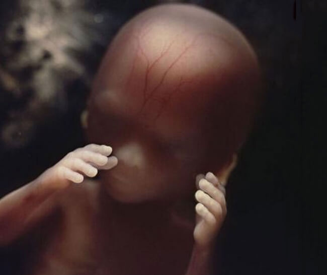 22 Stunning Pictures Depict The Stages Of Life Forming Until A Baby is Born 16