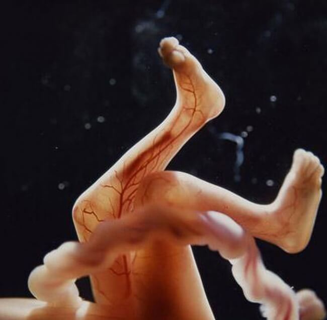 22 Stunning Pictures Depict The Stages Of Life Forming Until A Baby is Born 17