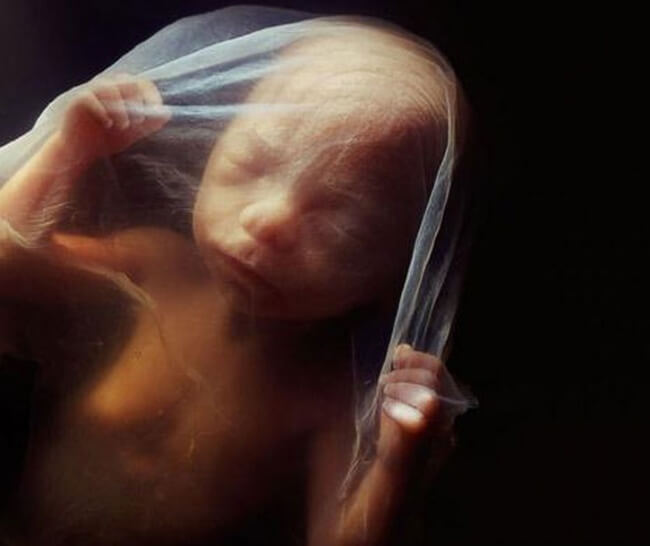 22 Stunning Pictures Depict The Stages Of Life Forming Until A Baby is Born 18