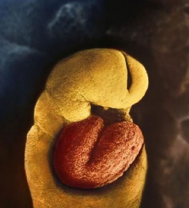 22 Stunning Pictures Depict The Stages Of Life Forming Until A Baby is Born 9